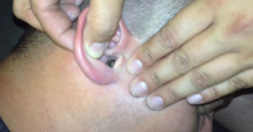 ear
